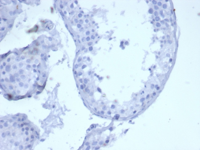 Cytokeratin 5 (KRT5) Antibody in Immunohistochemistry (Paraffin) (IHC (P))