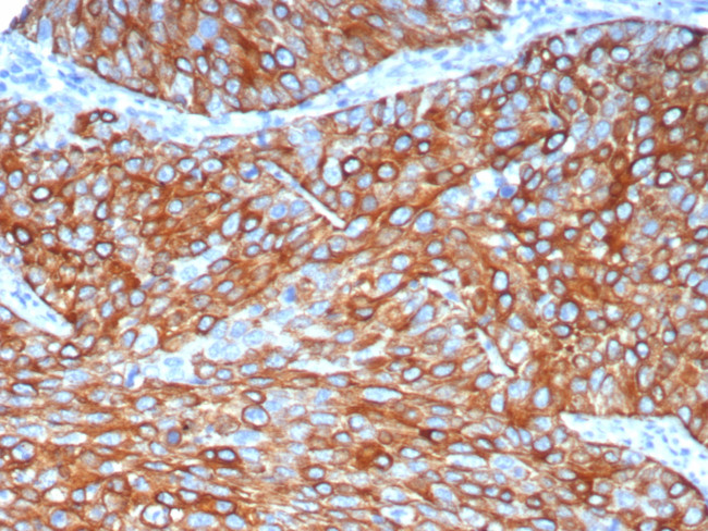 Cytokeratin 6A (KRT6A) (Basal Cell Marker) Antibody in Immunohistochemistry (Paraffin) (IHC (P))