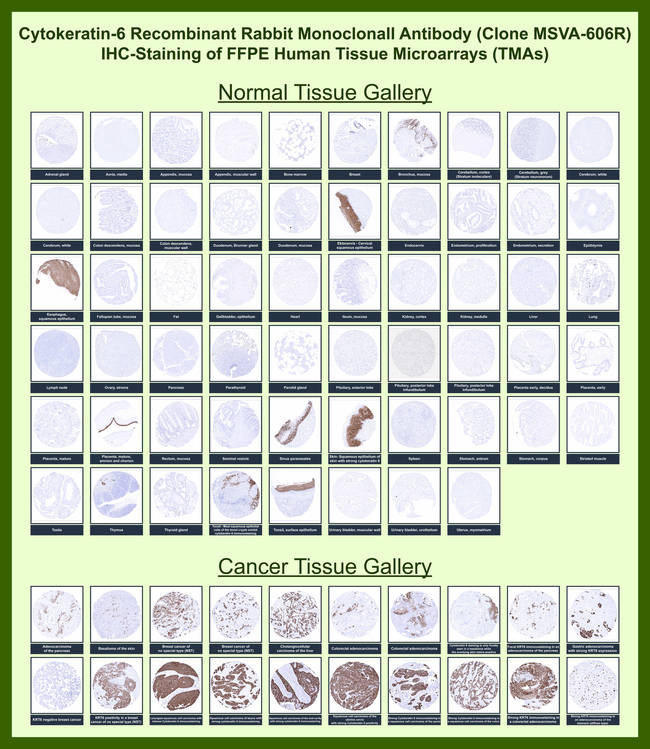 Cytokeratin 6A (KRT6A) (Basal Cell Marker) Antibody in Immunohistochemistry (Paraffin) (IHC (P))