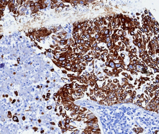 Cytokeratin 6A (KRT6A) (Basal Cell Marker) Antibody in Immunohistochemistry (Paraffin) (IHC (P))