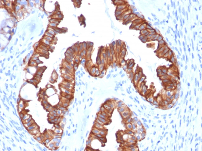 Cytokeratin 7 (Glandular and Transitional Epithelial Marker) Antibody in Immunohistochemistry (Paraffin) (IHC (P))
