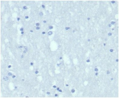 Cytokeratin 7 (Glandular and Transitional Epithelial Marker) Antibody in Immunohistochemistry (Paraffin) (IHC (P))