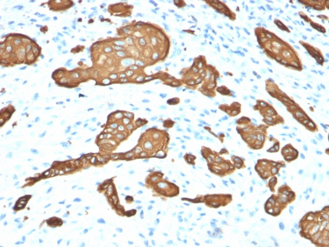 Cytokeratin 8 (KRT8) Antibody in Immunohistochemistry (Paraffin) (IHC (P))