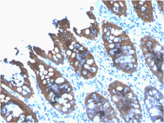 Cytokeratin 8 (KRT8) Antibody in Immunohistochemistry (Paraffin) (IHC (P))