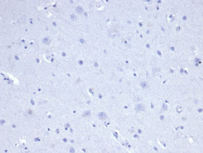 Cytokeratin 8 (KRT8) Antibody in Immunohistochemistry (Paraffin) (IHC (P))