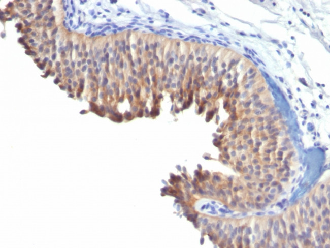 Cytokeratin 10 (KRT10) (Suprabasal Epithelial Marker) Antibody in Immunohistochemistry (Paraffin) (IHC (P))