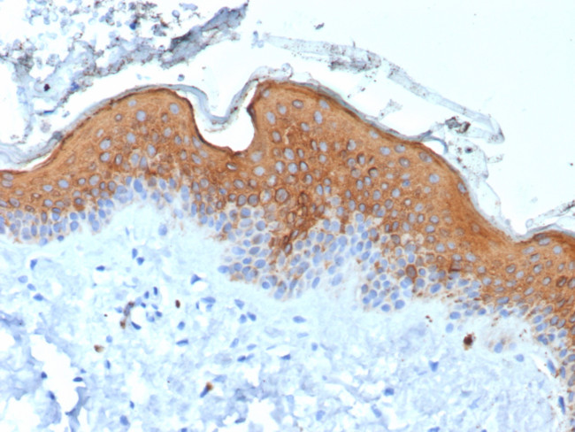 Cytokeratin 10 (Suprabasal Epithelial Marker) Antibody in Immunohistochemistry (Paraffin) (IHC (P))