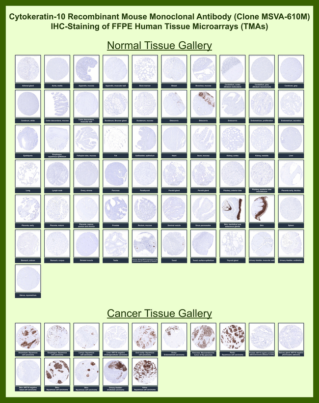 Cytokeratin 10 (Suprabasal Epithelial Marker) Antibody in Immunohistochemistry (Paraffin) (IHC (P))