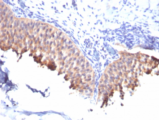 Cytokeratin 10 (Suprabasal Epithelial Marker) Antibody in Immunohistochemistry (Paraffin) (IHC (P))