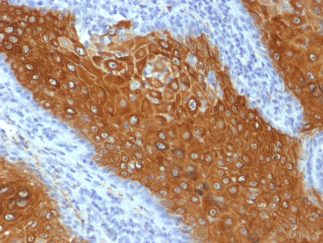Cytokeratin 10 (Suprabasal Epithelial Marker) Antibody in Immunohistochemistry (Paraffin) (IHC (P))