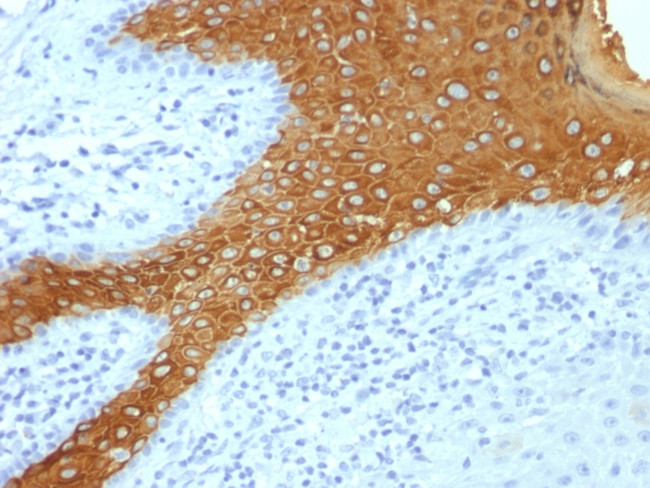 Cytokeratin 10 (Suprabasal Epithelial Marker) Antibody in Immunohistochemistry (Paraffin) (IHC (P))