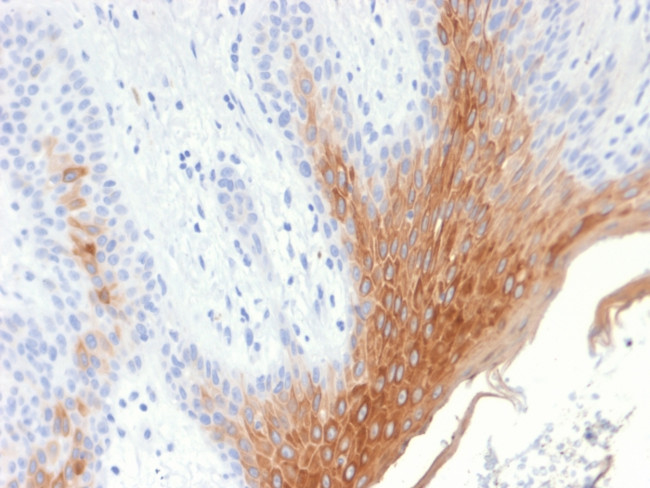Cytokeratin 10 (KRT10) (Suprabasal Epithelial Marker) Antibody in Immunohistochemistry (Paraffin) (IHC (P))