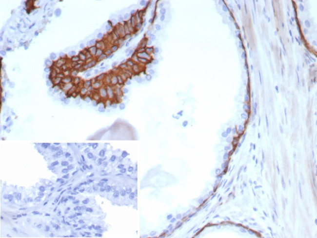 Cytokeratin 13 (Non-Keratinized Squamous Epithelial Marker) Antibody in Immunohistochemistry (Paraffin) (IHC (P))