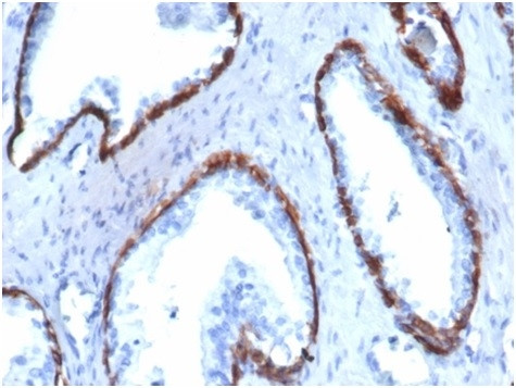 Cytokeratin 14 (KRT14) (Squamous Cell Marker) Antibody in Immunohistochemistry (Paraffin) (IHC (P))