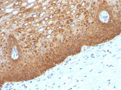 Cytokeratin 14 (KRT14) (Squamous Cell Marker) Antibody in Immunohistochemistry (Paraffin) (IHC (P))