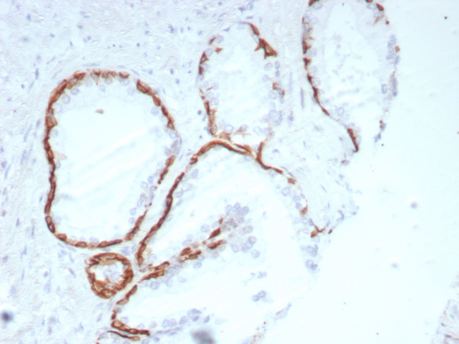 Cytokeratin 14 (KRT14) (Squamous Cell Marker) Antibody in Immunohistochemistry (Paraffin) (IHC (P))