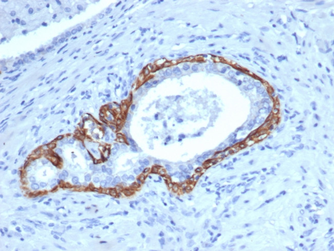 Cytokeratin 14 (KRT14) (Squamous Cell Marker) Antibody in Immunohistochemistry (Paraffin) (IHC (P))