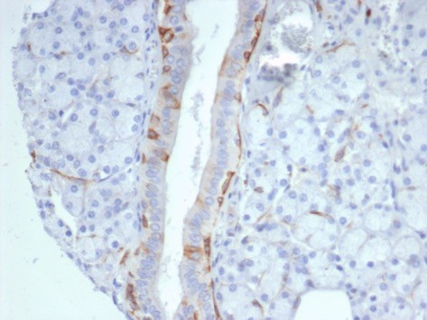 Cytokeratin 14 (KRT14) (Squamous Cell Marker) Antibody in Immunohistochemistry (Paraffin) (IHC (P))