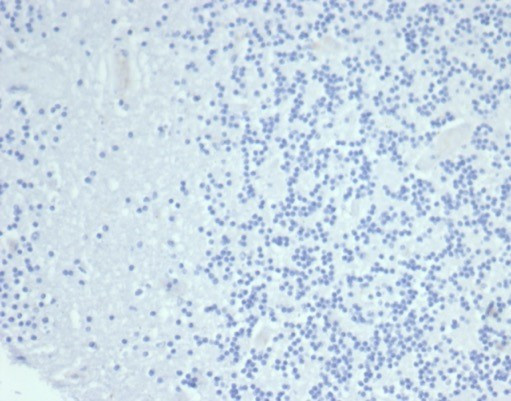 Cytokeratin 14 (KRT14) (Squamous Cell Marker) Antibody in Immunohistochemistry (Paraffin) (IHC (P))