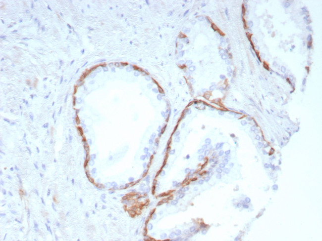 Cytokeratin 14 (KRT14) (Squamous Cell Marker) Antibody in Immunohistochemistry (Paraffin) (IHC (P))