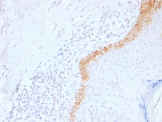 Cytokeratin 15 (Esophageal Squamous Cell Carcinoma Marker) Antibody in Immunohistochemistry (Paraffin) (IHC (P))