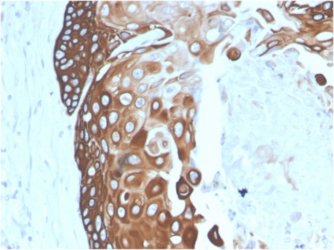 Cytokeratin 15 (Esophageal Squamous Cell Carcinoma Marker) Antibody in Immunohistochemistry (Paraffin) (IHC (P))