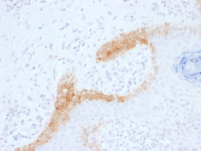 Cytokeratin 15 Antibody in Immunohistochemistry (Paraffin) (IHC (P))