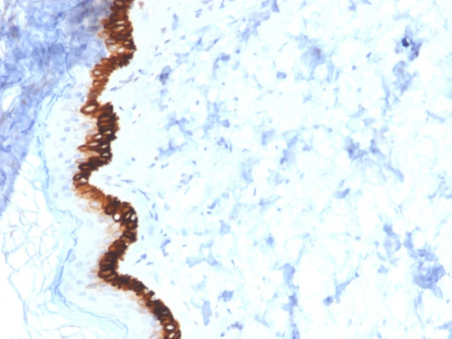 Cytokeratin 15 (Esophageal Squamous Cell Carcinoma Marker) Antibody in Immunohistochemistry (Paraffin) (IHC (P))