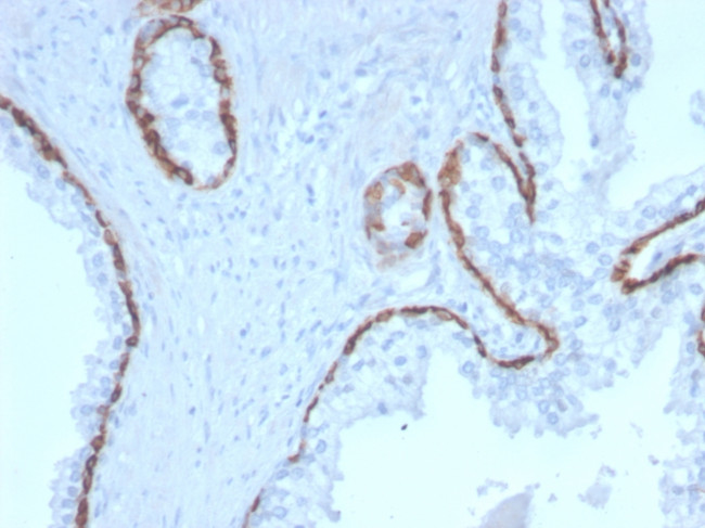 Cytokeratin 15 Antibody in Immunohistochemistry (Paraffin) (IHC (P))