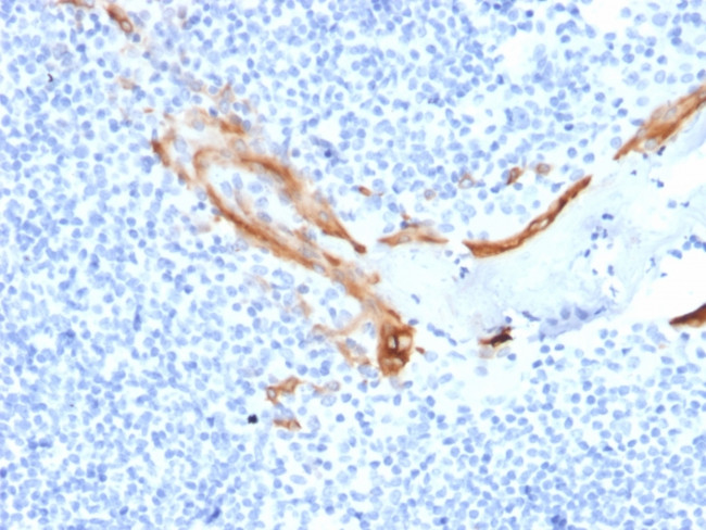 Cytokeratin 16 (KRT16) (Suprabasal Keratinocyte Marker) Antibody in Immunohistochemistry (Paraffin) (IHC (P))