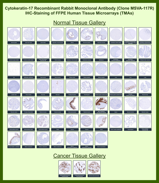 Cytokeratin 17 (CK17) (Basal Epithelial Marker) Antibody in Immunohistochemistry (Paraffin) (IHC (P))