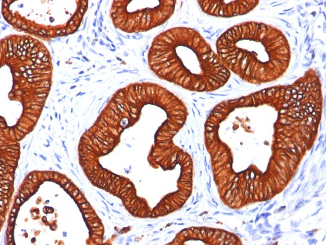 Cytokeratin 18 (KRT18) Antibody in Immunohistochemistry (Paraffin) (IHC (P))