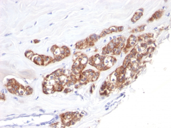 Cytokeratin 18 (KRT18) Antibody in Immunohistochemistry (Paraffin) (IHC (P))
