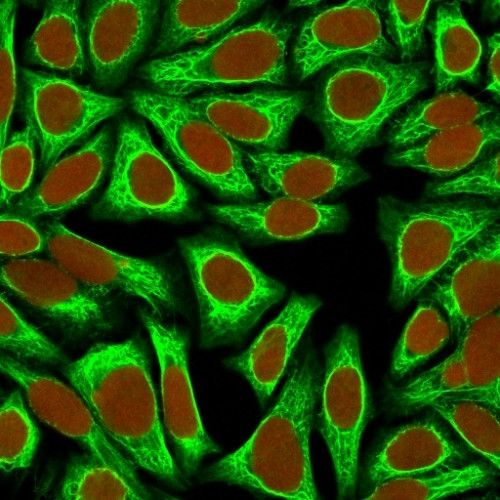 Cytokeratin 18 (KRT18) Antibody in Immunocytochemistry (ICC/IF)