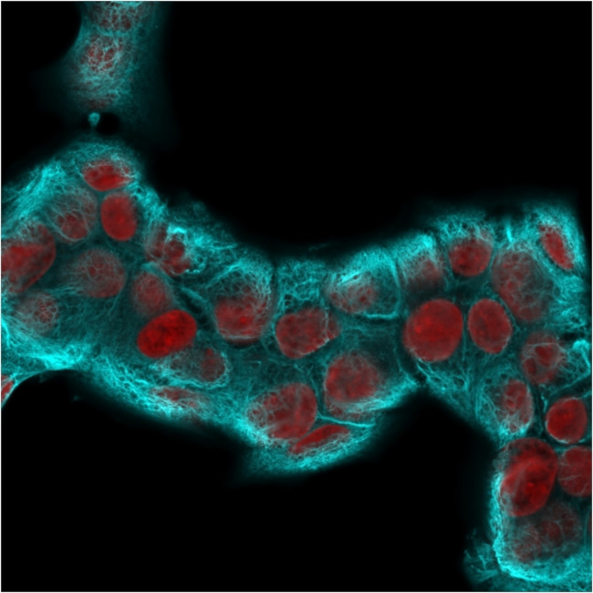 Cytokeratin 18 (KRT18) Antibody in Immunocytochemistry (ICC/IF)