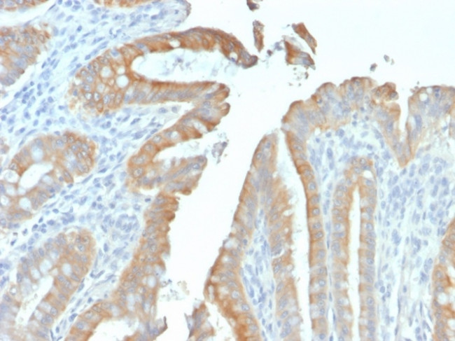 Cytokeratin 19 (KRT19) Antibody in Immunohistochemistry (Paraffin) (IHC (P))
