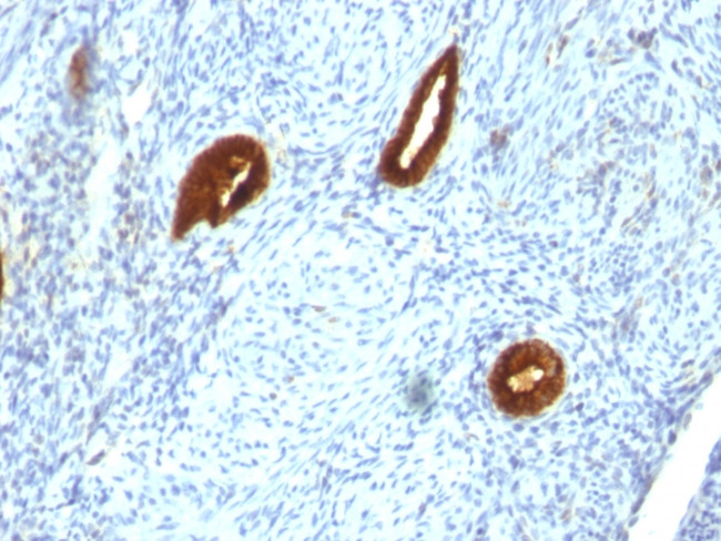 Cytokeratin 19 (KRT19) (Pancreatic Stem Cell Marker) Antibody in Immunohistochemistry (Paraffin) (IHC (P))