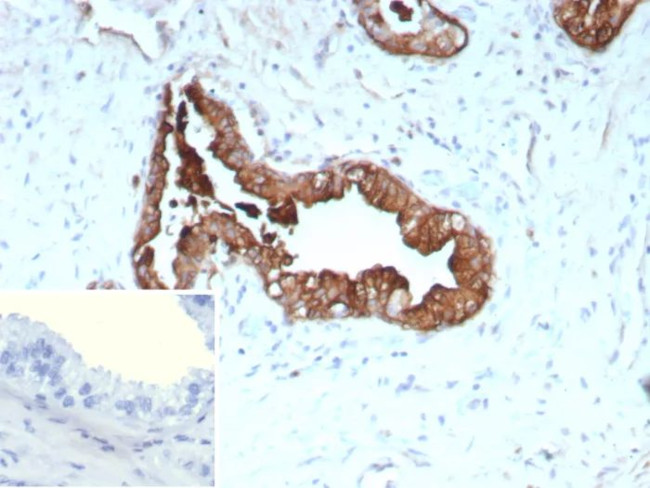 Cytokeratin 19 (Pancreatic Stem Cell Marker) Antibody in Immunohistochemistry (Paraffin) (IHC (P))