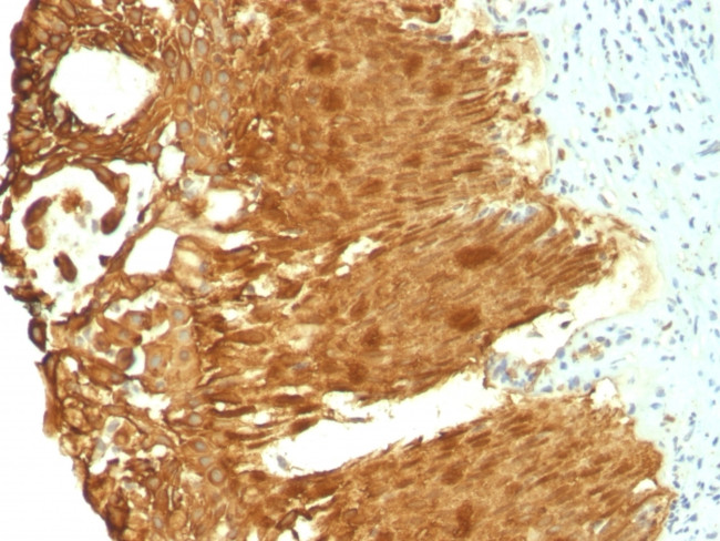 Cytokeratin 19 (KRT19) (Pancreatic Stem Cell Marker) Antibody in Immunohistochemistry (Paraffin) (IHC (P))