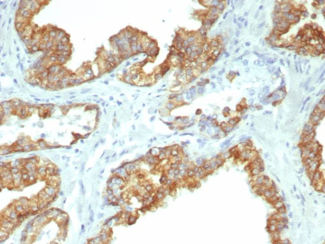 Cytokeratin 19 (Pancreatic Stem Cell Marker) Antibody in Immunohistochemistry (Paraffin) (IHC (P))
