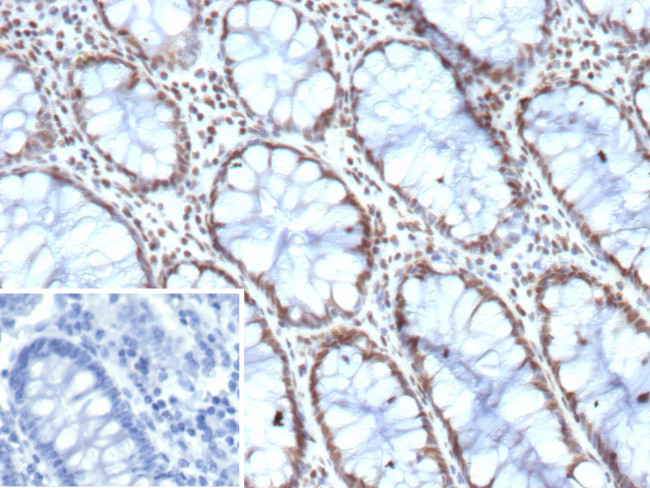 HES5/bHLHb38/Hes family bHLH transcription factor 5 Antibody in Immunohistochemistry (Paraffin) (IHC (P))