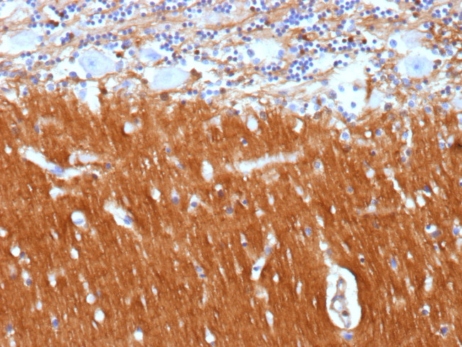 CD171/NCAM-L1 (L1 Cell Adhesion Molecule) Antibody in Immunohistochemistry (Paraffin) (IHC (P))