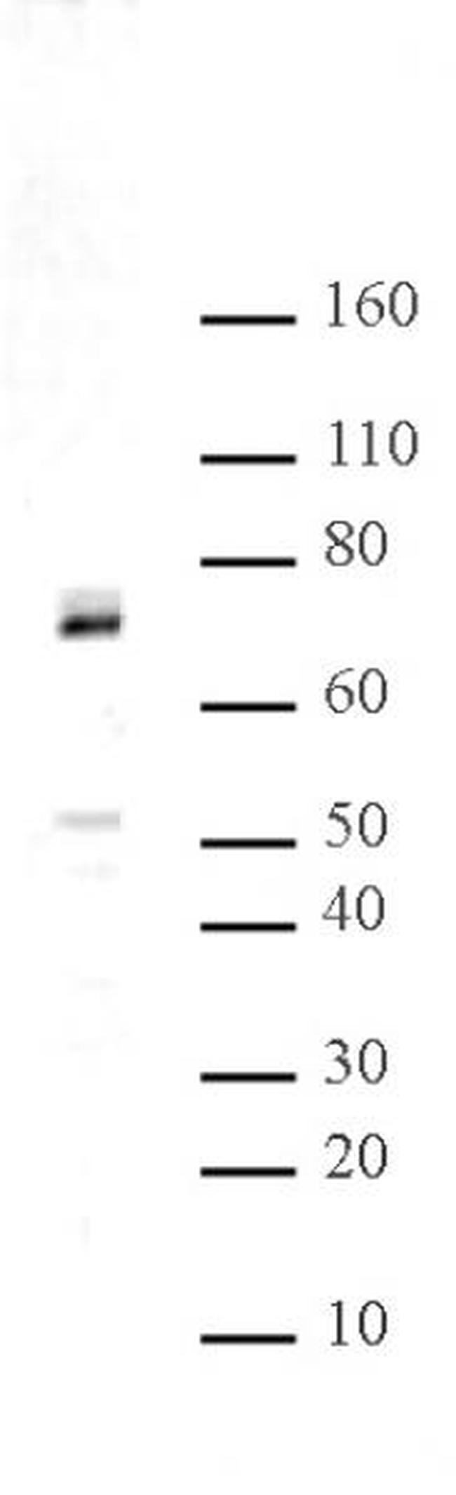 Hbo1 Antibody in Western Blot (WB)
