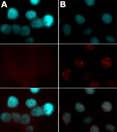 Phospho-Histone H2A.X (Ser139) Antibody in Immunocytochemistry (ICC/IF)
