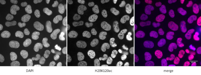 Histone H2BK120ac Antibody in Immunocytochemistry (ICC/IF)