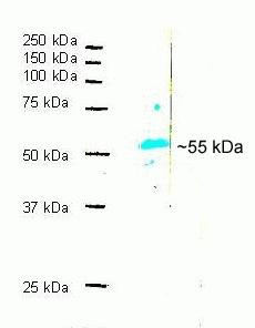 alpha Synuclein Antibody in Western Blot (WB)