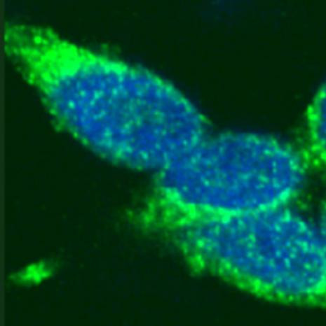 Rad51 Antibody in Immunocytochemistry (ICC/IF)