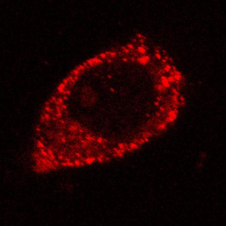 Rad52 Antibody in Immunocytochemistry (ICC/IF)