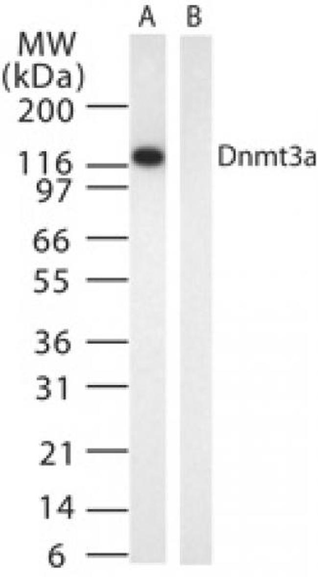 DNMT3A Antibody in Western Blot (WB)