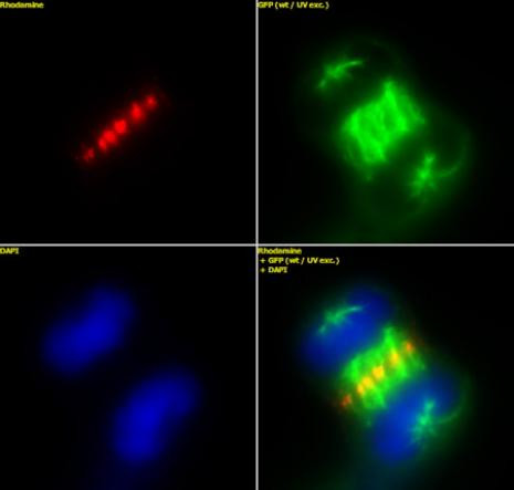 INCENP Antibody in Immunocytochemistry (ICC/IF)